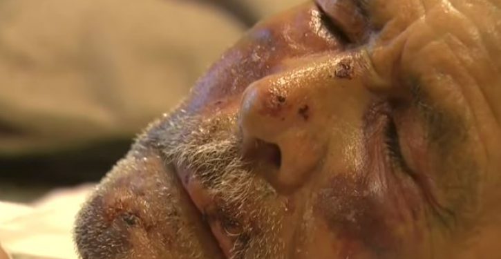 91-year-old Mexican beaten with concrete block, told ‘go back to your own country’: Whodunnit?
