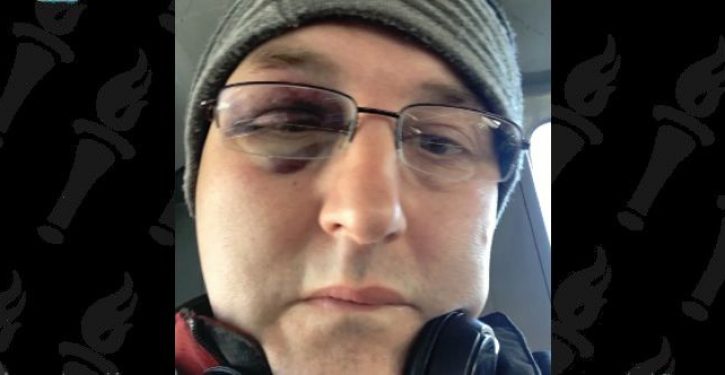 Man says bus driver attacked him because he couldn’t speak French