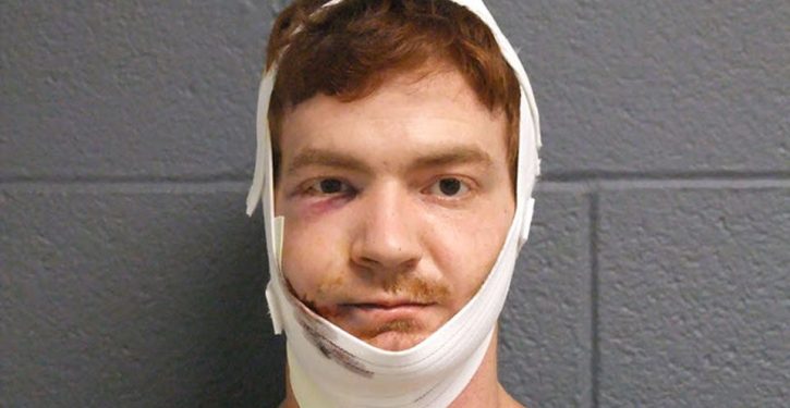 Man accused of shooting officer in face is himself shot in face during arrest