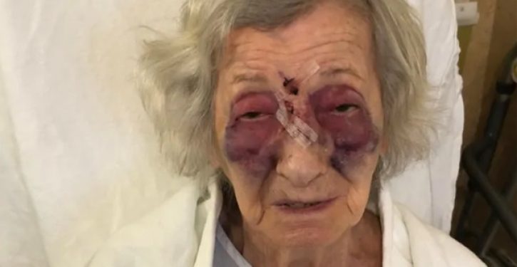 Holocaust survivor badly beaten by stranger in unprovoked attack