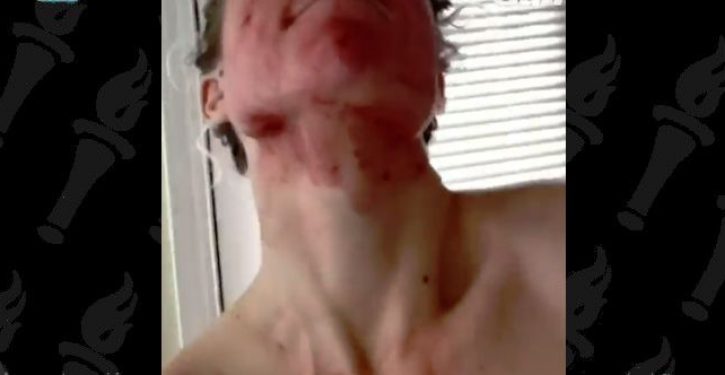 Woman smears menstrual blood on her face to show periods are ‘beautiful’ and ‘powerful’