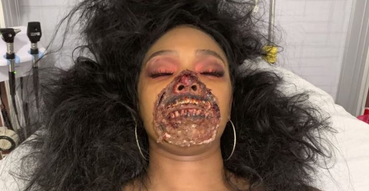 Dancer’s zombie-inspired Halloween makeup mistaken for medical emergency at hospital