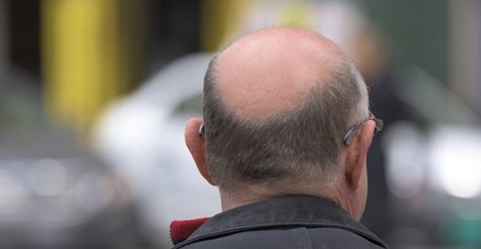 Insulting bald men is now sexual harassment in England by LU Staff