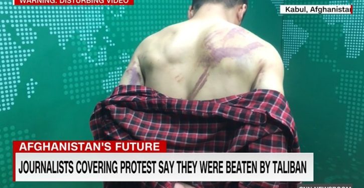 Afghan journalists savagely beaten by Taliban describes their ordeal