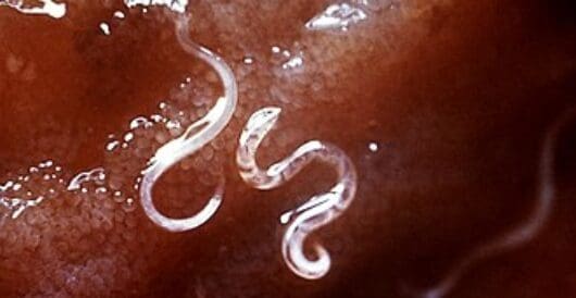 Vaccine boosts the fight against hookworm, which makes millions of people lethargic by Hans Bader