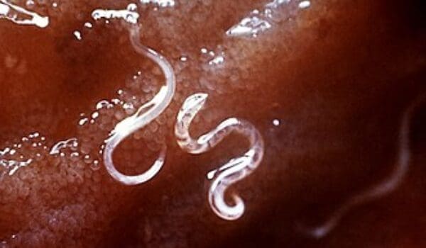 Vaccine boosts the fight against hookworm, which makes millions of people lethargic by Hans Bader